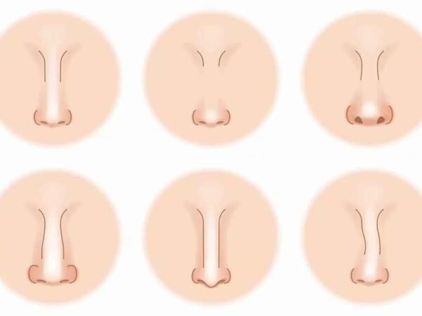 Common Nose Shapes That Rhinoplasty Can Help