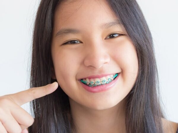 Top Reasons to Choose Orthodontic Braces in Flushing Today