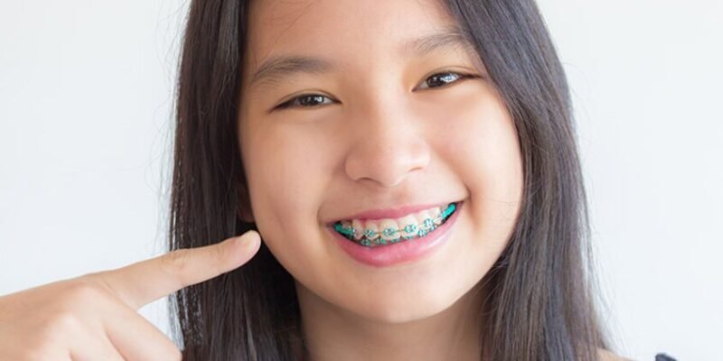 Top Reasons to Choose Orthodontic Braces in Flushing Today