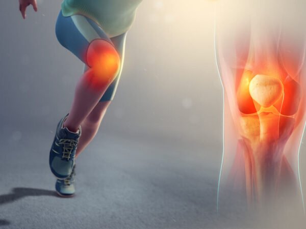 5 Effective Methods to Reduce Knee Arthritis Pain at Home